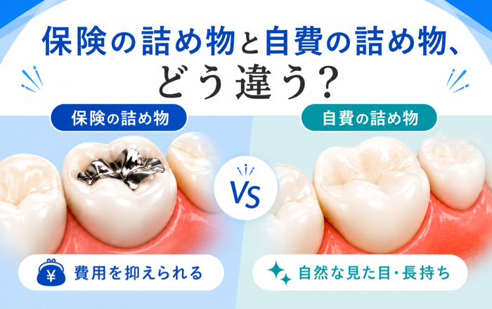 歯の詰め物は保険と自費で何が違う