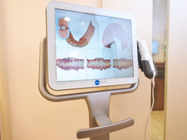 口腔内スキャナ(iTero)